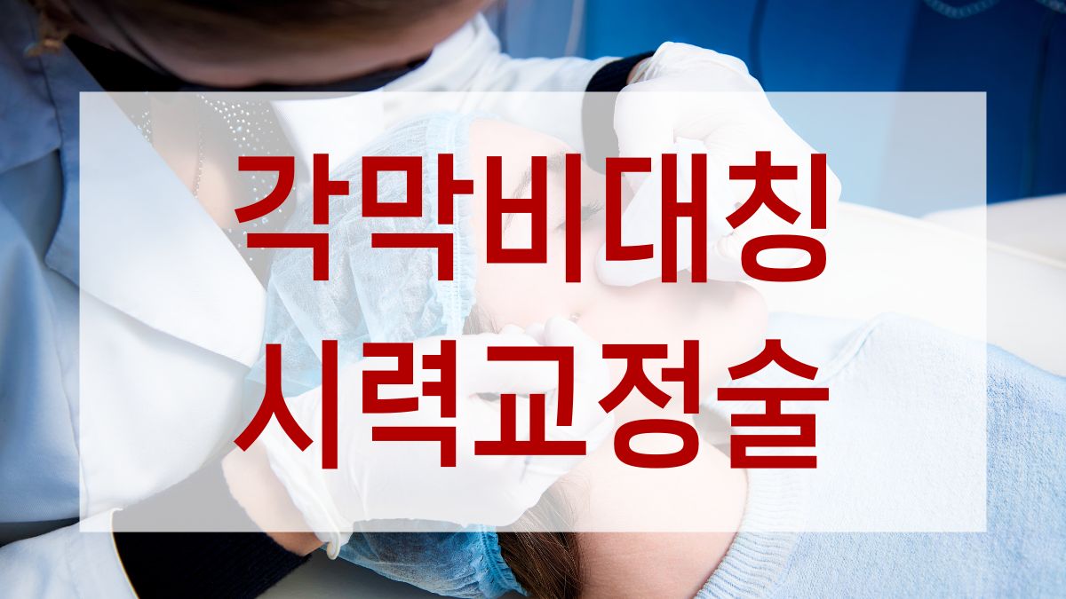 각막비대칭 시력교정술