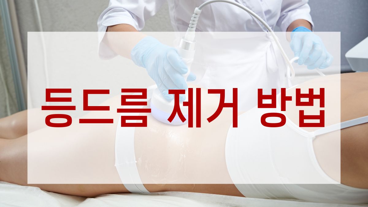 등드름 제거 방법