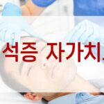 이석증 자가치료