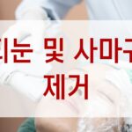 티눈 및 사마귀 제거