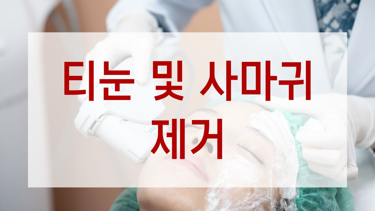 티눈 및 사마귀 제거