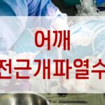 어깨 회전근개파열수술