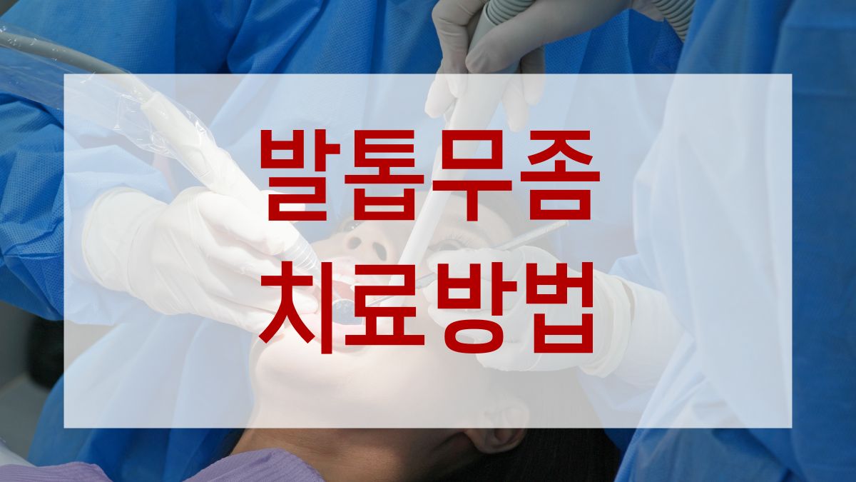 발톱무좀 치료방법