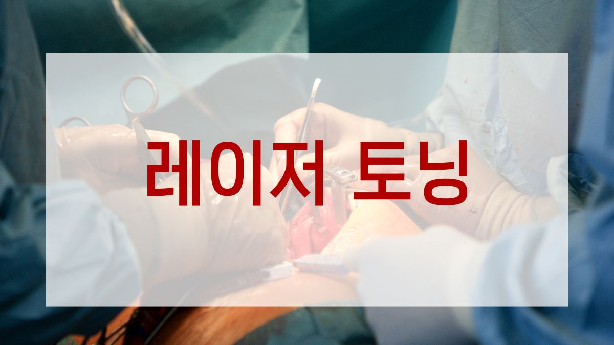 레이저 토닝