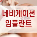 네비게이션임플란트