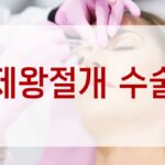 제왕절개 수술