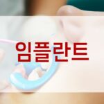 임플란트