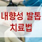 내향성 발톱 치료법